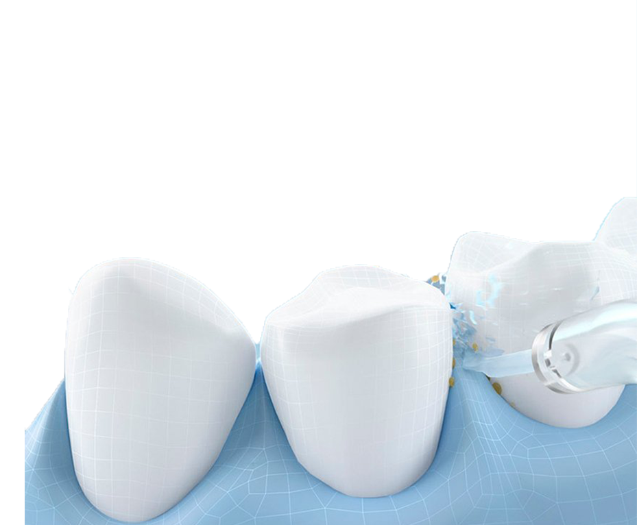 Чистка зубов Air-Flow