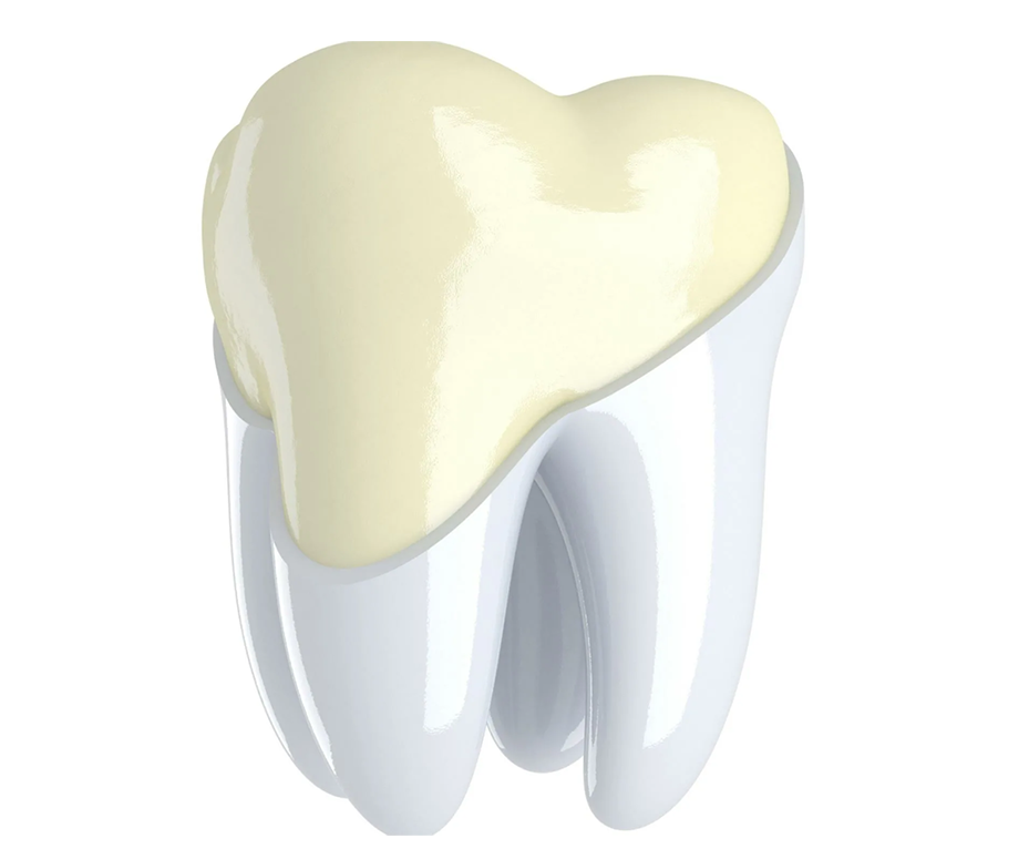 Укрепление зубной эмали