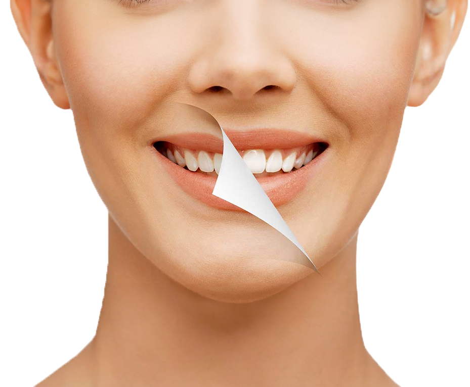 Фторирование зубов