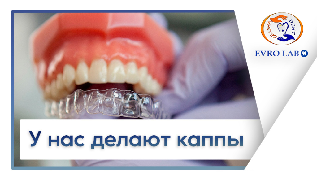 Баннер элайнеры каппы.jpg