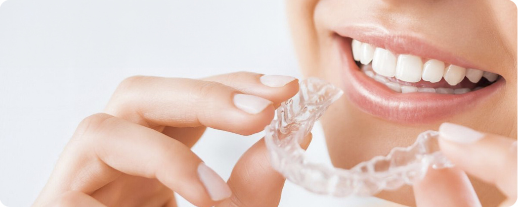 'элайнеры в королеве элайнеры в королеве